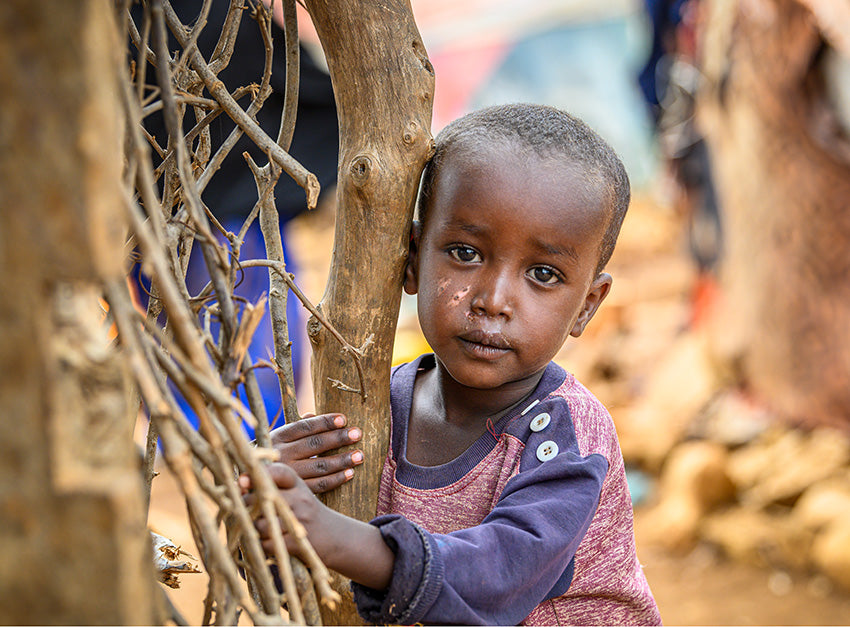 A toddler with wounds on his face looks straight ahead as he holds onto a stick like structure.